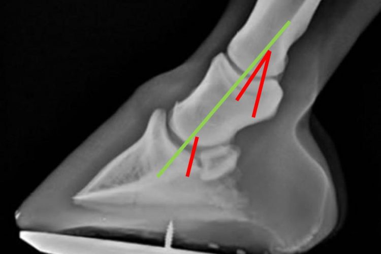 Fussung in Nullstellung, Bandapparat